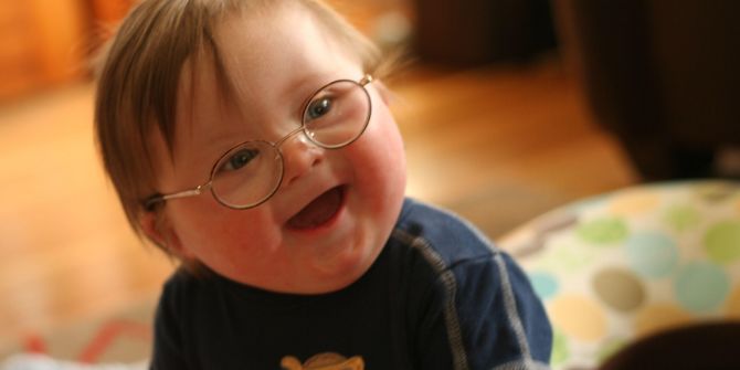 Down Sendromlu çocuklara, bireylere nasıl davranılmalı? 21 Mart  Dünya Down Sendromu Farkındalık Günü