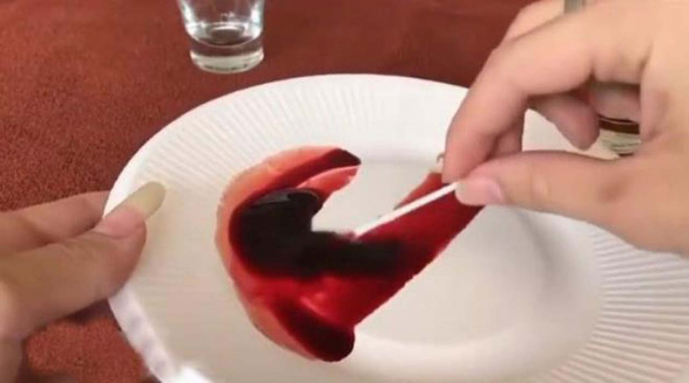 Çılgın deneyci herkesi şoke etti: Bir damla yılan zehri bakın kanı ne hale getirdi! 10