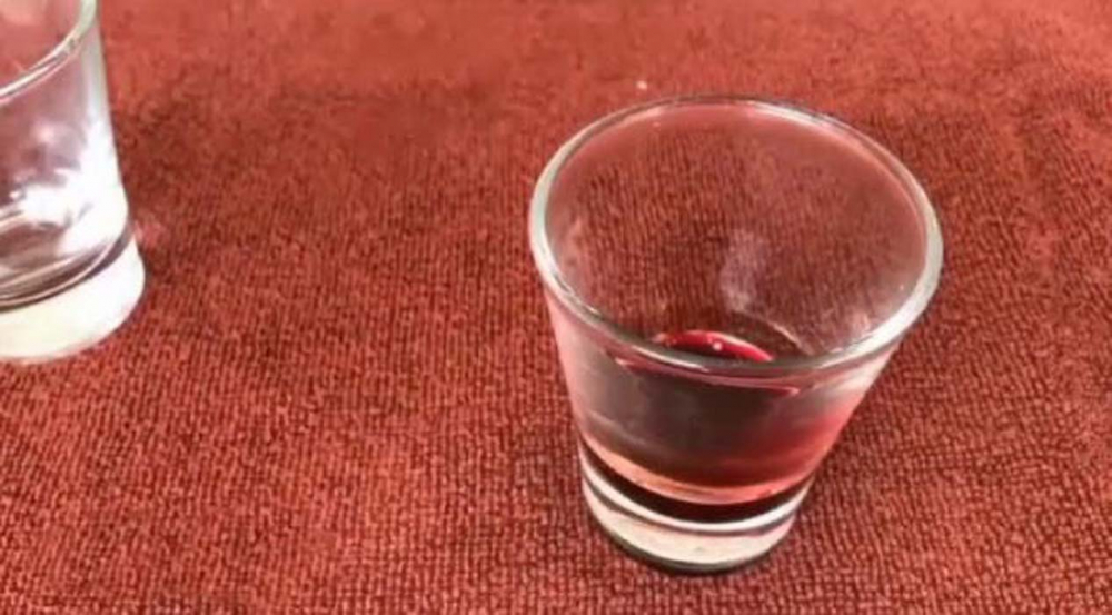 Çılgın deneyci herkesi şoke etti: Bir damla yılan zehri bakın kanı ne hale getirdi! 9