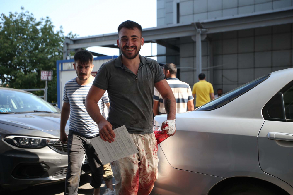 Kurban Bayramı klasiği gerçek oldu! Acemi kasaplar, acil servisleri doldurdu 2