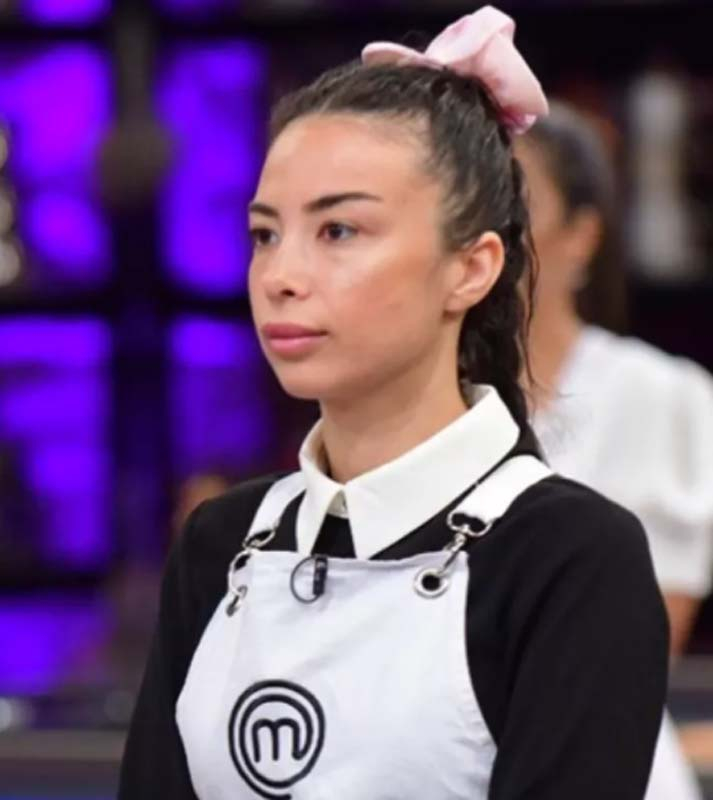 Masterchef Burcu Önal'ın estetiksiz hali olay oldu! Görenler gözlerine inanamadı! 11