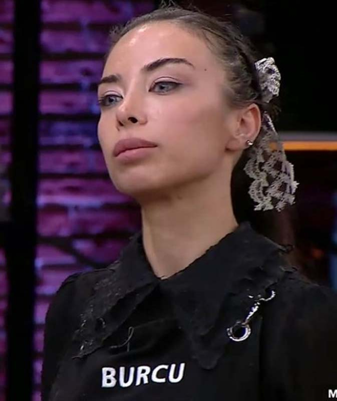 Masterchef Burcu Önal'ın estetiksiz hali olay oldu! Görenler gözlerine inanamadı! 4