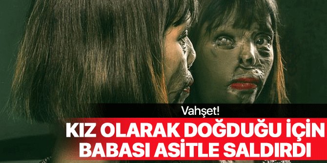 Kız olarak doğduğu için babası yüzüne asit döktü!