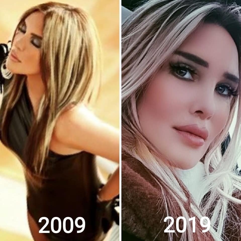 Ünlülerin 10 years challenge paylaşımları! 15