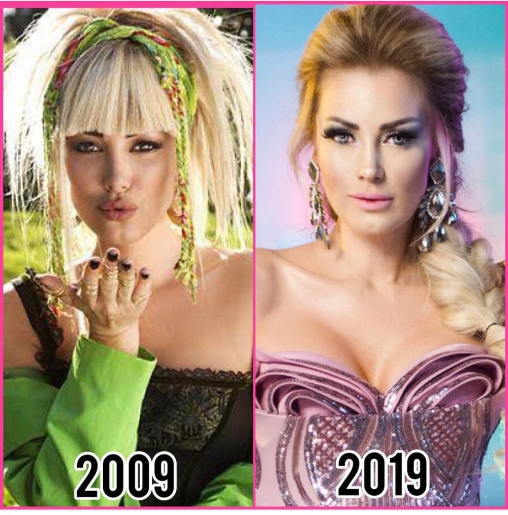 Ünlülerin 10 years challenge paylaşımları! 9