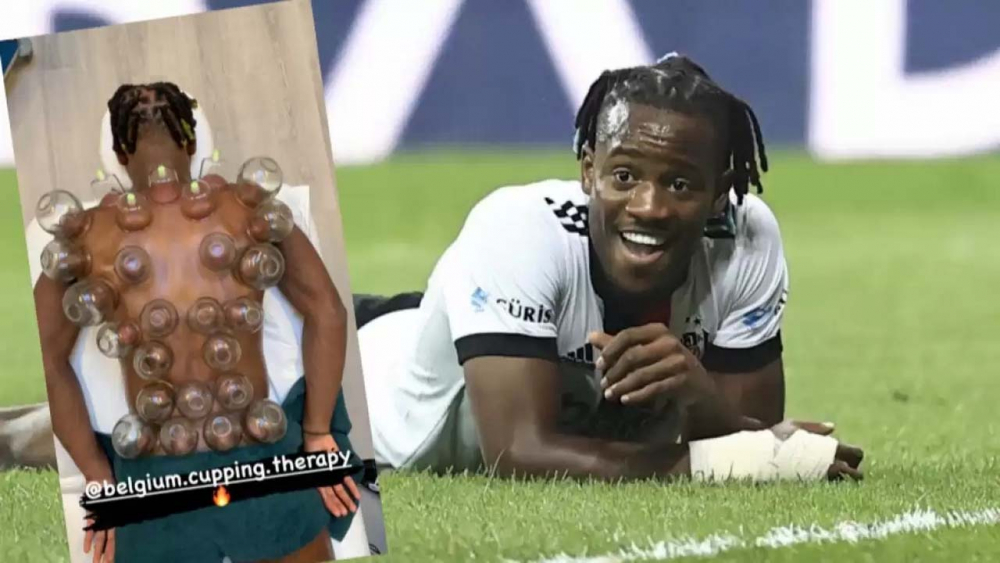 Michy Batshuayi hacamat yaptırdı, sosyal medyada viral oldu! Kaçırdığı gol sayısı kadar bardak koydurmuş! 6