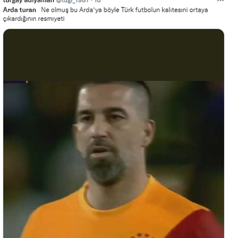 Fenerbahçe - Galatasaray derbisinde Arda Turan'ın son hali şaşırttı! Görenler inanamadı! "Ne olmuş böyle" 5