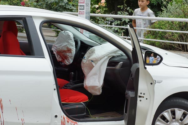 Kız arkadaşıyla otomobilde oturuyordu! Babası omzuna falçata sapladı 4