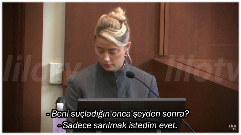 Amber Heard ile çekişmesinde Johnny Depp'in sürekli gözlüklü olmasının nedeni ortaya çıktı! 5