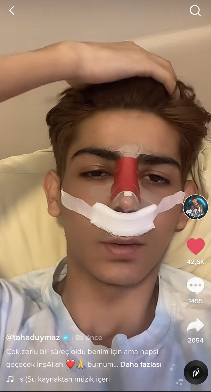 TikTok fenomeni Mika Raun'dan sonra Taha Duymaz da estetik oldu! Eski halini unutun! "Paranın gücü" 6