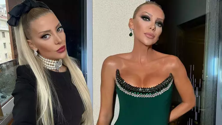 Gülşah Saraçoğlu'nun estetik ameliyatı 9 saat sürdü: Son halini paylaştı, görenleri şok etti!