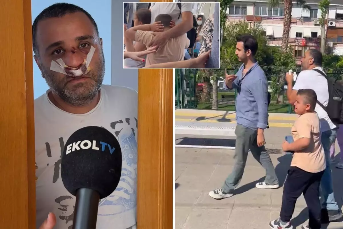Çocuklarının gözü önünde dövüldü: Darp edilen o baba sessizliğini bozdu!