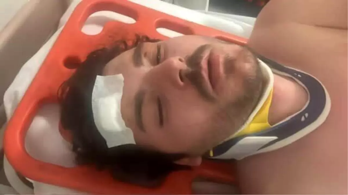 Ünlü oyuncu trafikte 4 kişi tarafından ölesiye dayak yedi: Kamyoncu araya girmeseydi ölecektim!