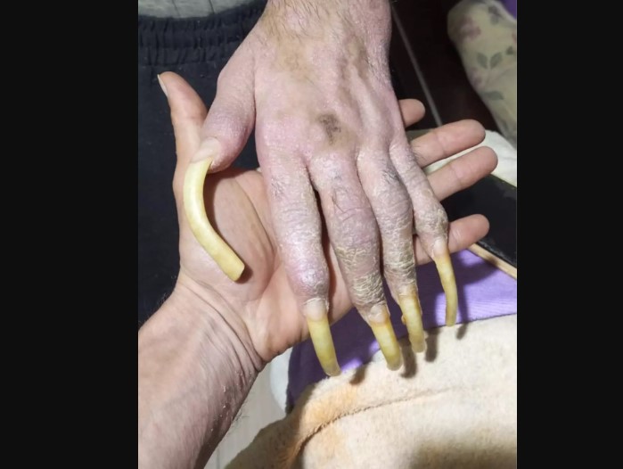 Telefon bağımlısı genç gündem oldu: 3 yıldır duş bile almadım, elimde olsa tuvalete de gitmem, yemek de yemem...