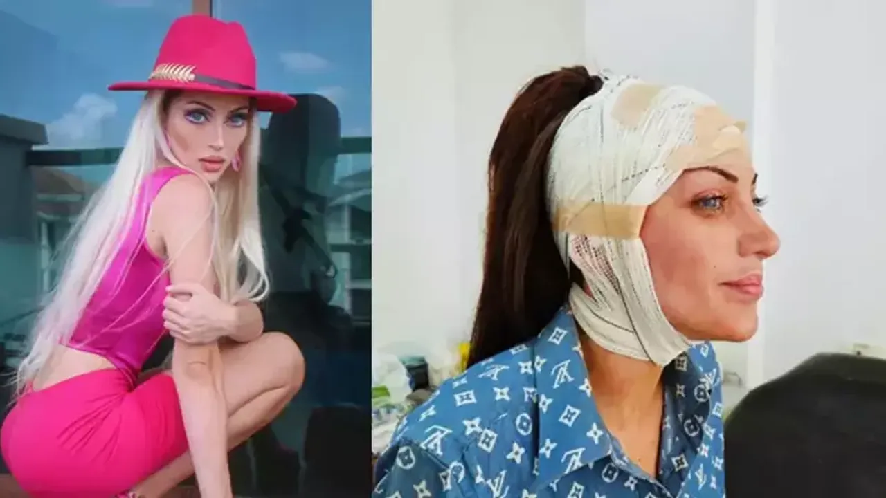 Barbie'ye benzeme sevdası canından etti: 27 kez ameliyat olan Fenomenin gizemli ölümü!