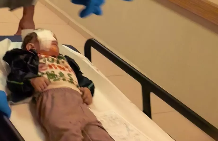 Çocukların oynadığı torpil facia getirdi: 2 yaşındaki bebek gözünü kaybetti!