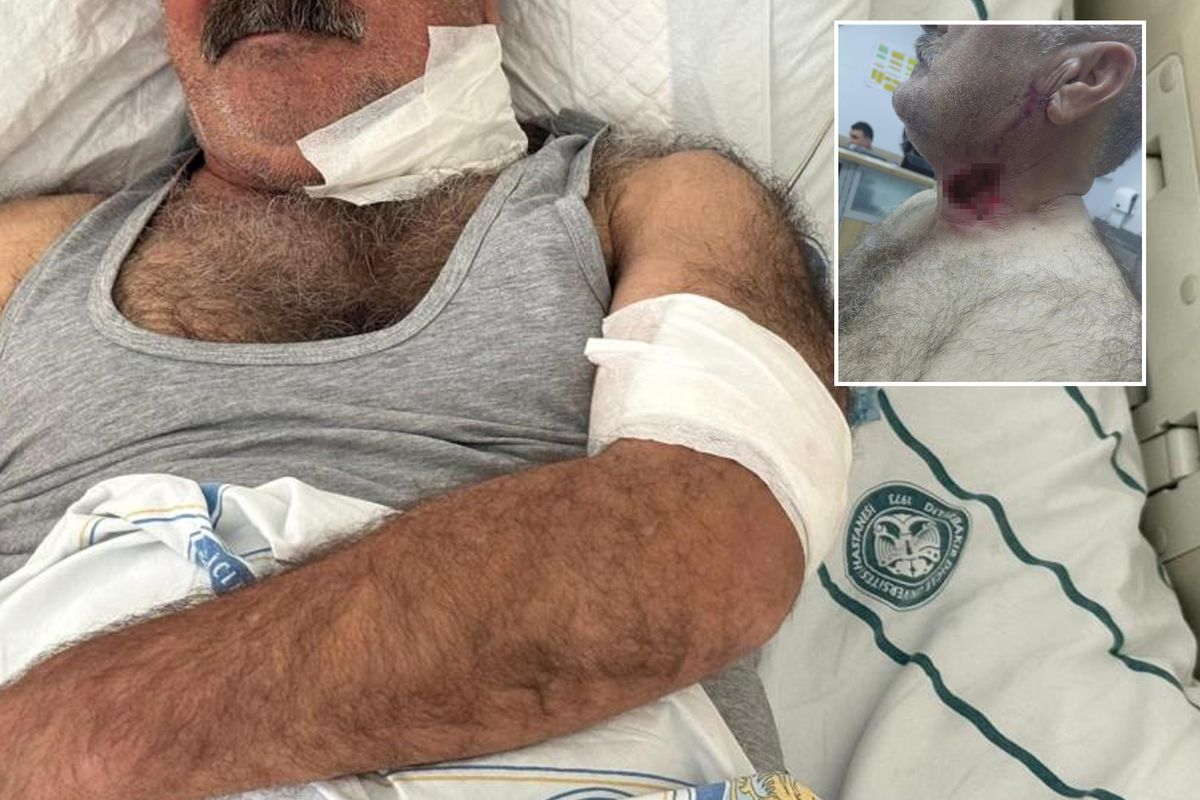 Diyarbakır'da korkunç olay: Hırçın at sahibini boğazından ısırarak ağır yaraladı!