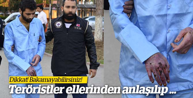 DEAŞ'lı teröristler hastanede yakayı ele verdiler