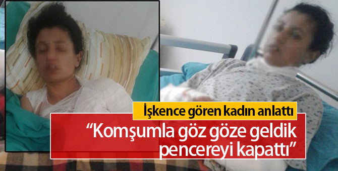 Kocasından işkence gören kadın anlattı: Komşular duyunca pencereyi kapattı