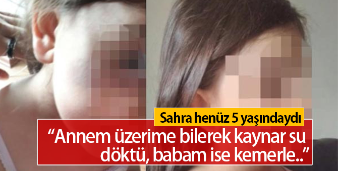 5 Yaşındaki Sahra Anne ve Babasından İşkence Gördü