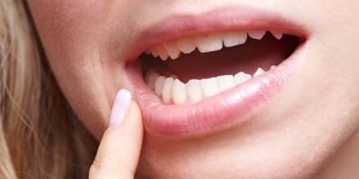 Ağız mantarı nedir? Neden olur? Bulaşıcı mıdır? | Ağız mantarı nasıl geçer?