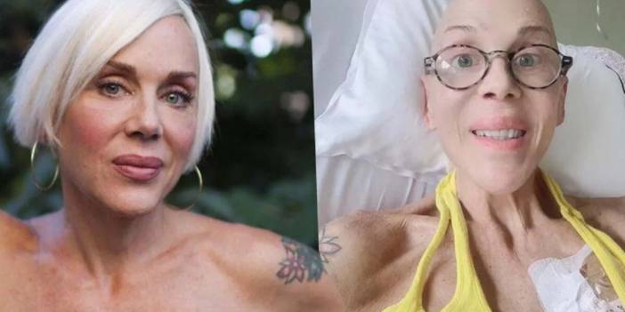 Billur Kalkavan kimdir? Nereli? Kaç yaşında, neden öldü? Hastalığı neydi? Ne kanseriydi? Billur Kalkavan'ın biyografisi