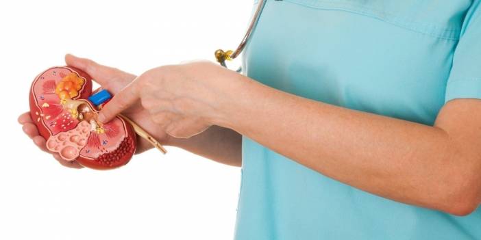 Böbrek Taşı İçin Hangi Doktora Gidilir? Böbrek Taşına Hangi Doktor Bakar, Hangi Bölümden Randevu Alınır?