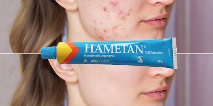 Hamaten Nedir? Hametan Ne İşe Yarar?