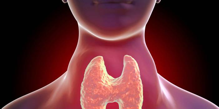 Zehirli Guatr Belirtileri Nelerdir? Zehirli Guatr Ölüm Oranı Kaç?