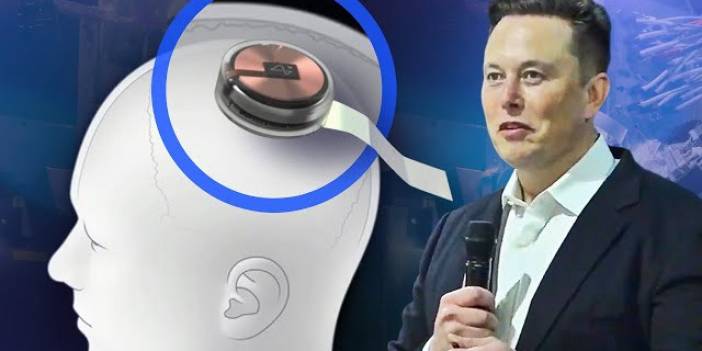 Bilim kurgu değil, gerçek! Neuralink onay aldı: Beynine çip taktırmak isteyen insanlar aranıyor!
