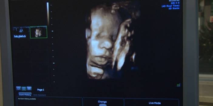 AIDS hastalığı Türkiye nüfusunu tehdit ediyor! 2021 yılında 32 bin olan HIV pozitif hasta sayısı iki kat arttı!