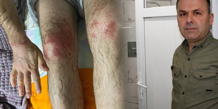 Yaş betona dokununca olanlar oldu! "Kesinlikle temas etmesinler"