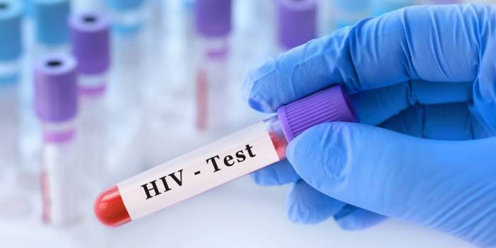 Bilim insanları, HIV virüsünün tedavisi konusunda ilerleme kaydetti