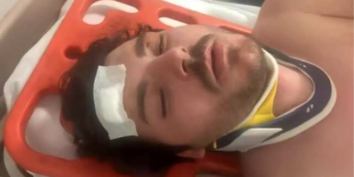 Ünlü oyuncu trafikte 4 kişi tarafından ölesiye dayak yedi: Kamyoncu araya girmeseydi ölecektim!