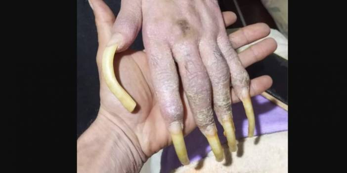 Telefon bağımlısı genç gündem oldu: 3 yıldır duş bile almadım, elimde olsa tuvalete de gitmem, yemek de yemem...