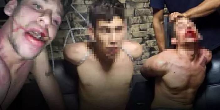 Türkiye bu insanlık dışı işkenceyi konuşuyor: Böcek yedirip, dişlerini kırdılar! İşte, o caniler hakkında istenen ceza