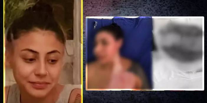 Kadıköy’de kıskançlık krizine giren kadın, sokak ortasında diğer kadını yaktı!