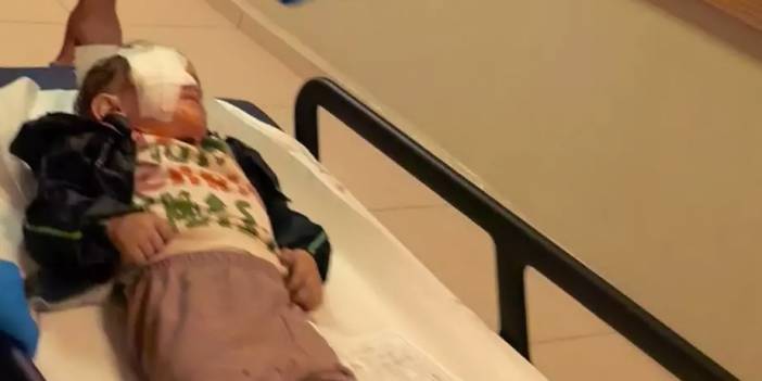 Çocukların oynadığı torpil facia getirdi: 2 yaşındaki bebek gözünü kaybetti!