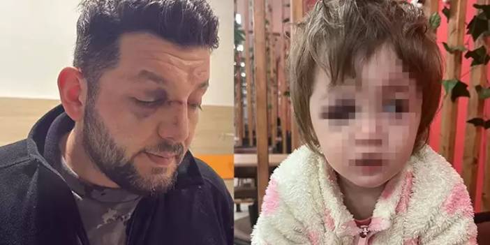 Yalova'da baba ve kıza saldıran o cani komşu için istenen ceza belli oldu!