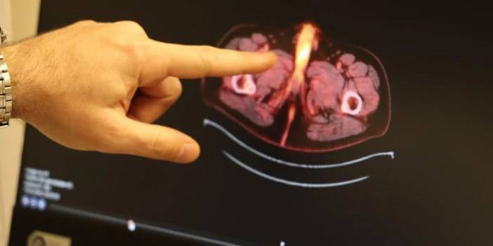 Tıp literatürüne giren son isim: Diyarbakırlı gencin penisi alındı!