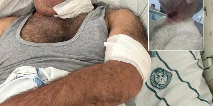 Diyarbakır'da korkunç olay: Hırçın at sahibini boğazından ısırarak ağır yaraladı!