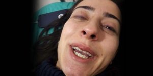 Ankara'daki tren kazasından yaralı olarak kurtulan yolcu dehşet anları anlattı!