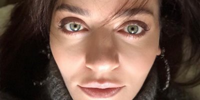 Ünlü oyuncu tanınmaz hale geldi! Sahte doktor şoku!