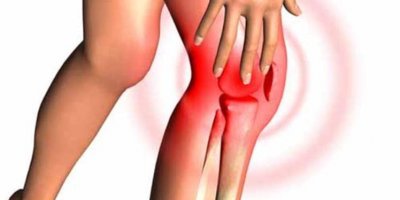 Diz çıkması nedir, nasıl olur? Ne kadar sürede iyileşir? Diz kapağı çıkması