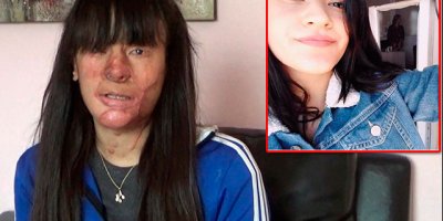 Berfin yüzünü ve güzelliğini çaldı: Sadece 13 yıl hapis cezası aldı