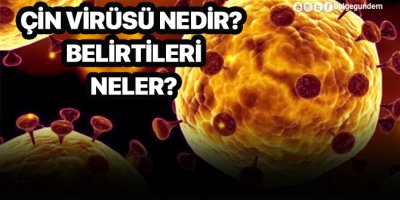 Çin virüsü nedir? Belirtileri neler? Bulaşıcı mı?