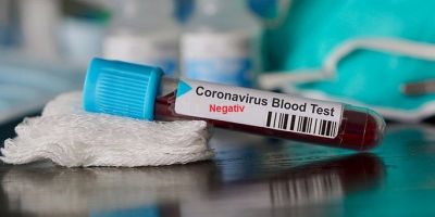 Koronavirüse karşı tedavi çalışmalarında sevindiren haber