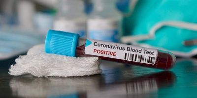 Koronavirüs testi hangi hastanelerde yaptırılır?