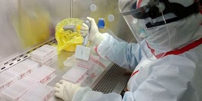 İTÜ'den koronavirüs için dev adım: 90 dakikada virüsü tespit edebilecekler