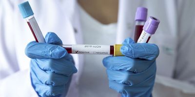 Sağlık Bakanlığı ve İletişim Başkanlığı yayımladı! İşte Türkiye’nin koronavirüs tablosu